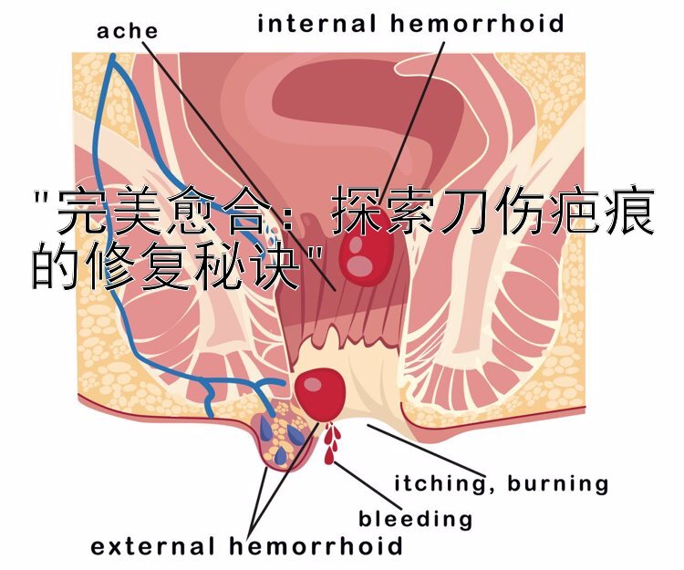 完美愈合：探索刀伤疤痕的修复秘诀